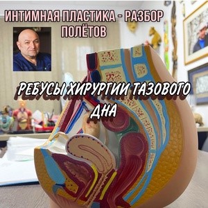 Интимная пластика — разбор полётов №7