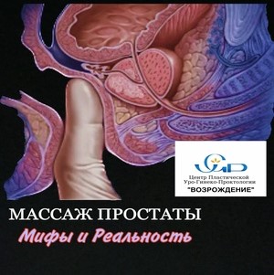 Массаж простаты. Мифы и реальность